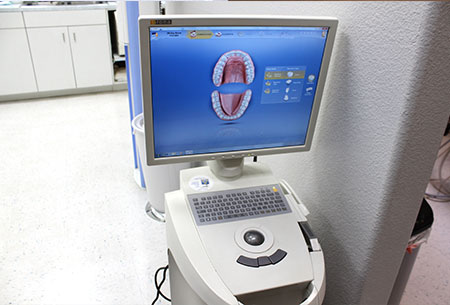 exceptional dentistry cerec machine